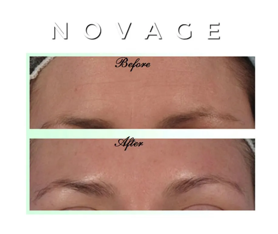 Novage Anti-Aging Cream - MQO 25 pcs